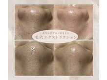 ルミナ(Lumina)の雰囲気（お悩み別に合わせたフェイシャルオーダーメイドケア）