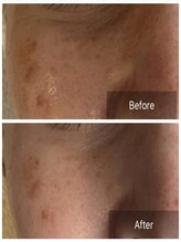 ヴィオラス(VIOLUS)/