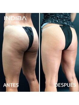 シュプリーム ラ ディオサ(Supreme LA DIOSA)/