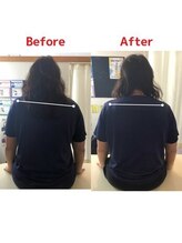 蕨整体院/蕨/整体/脚長差/骨盤矯正