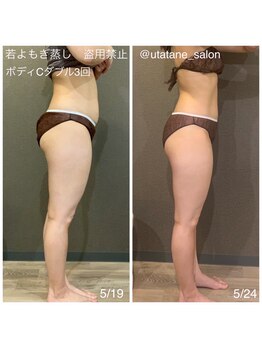 マロカ(Marroka)/【若よもぎ蒸しボディCの結果8】