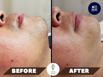 ヴォアール 名古屋店(VOIR)