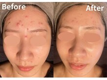 サロン デ ミロ(Salon de Miro)/BeforeAfter多数！ブログへGO♪