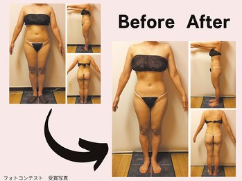 ミネルバエンダモロジー/エンダモロジー/痩身/ウェルネス