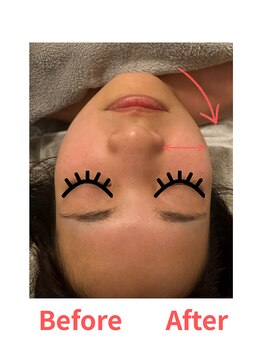 レポリア(Reporia)/EMSヘッドブラシBeforeAfter