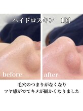 エムラボ 新宿店(M LABO)/ビフォーアフター