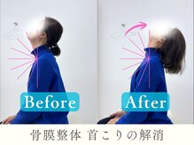 ヒラメント 浜松町(Hilament)/ビフォーアフター：首こり