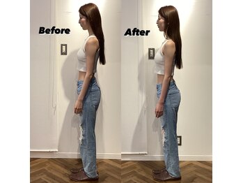 コルミチョン サロン(骨美整 salon)/姿勢　Before・After 