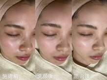 アルム(a'lm)/幹細胞ケアでくすみ赤みを撃退！