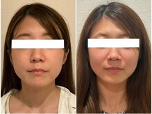 美容整体ウェリナ あま甚目寺院/小顔矯正/骨盤矯正/美脚サロン