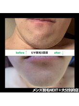 ネクストプラス 大分別府店(NEXT+)/ビフォーアフター