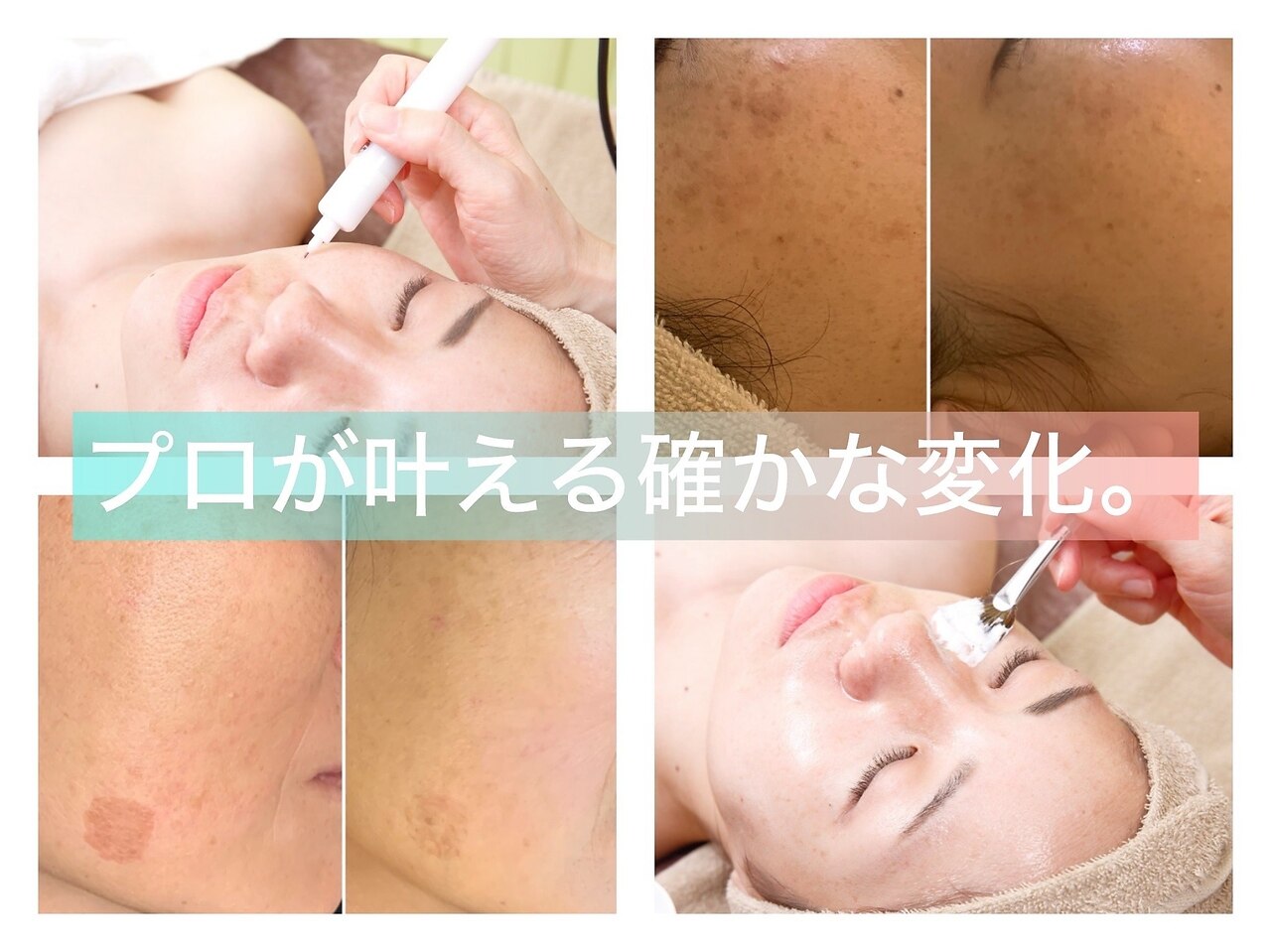 エクシア(ECXIA)｜ホットペッパービューティー