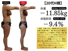 20代のお客様before＆after