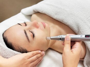 リンネ(Rin'ne)の写真/【エステ版ソフトダーマ】しみ・小じわ改善や毛穴の開き・くすみなどお悩みの方、ぜひ一度ご体感ください♪