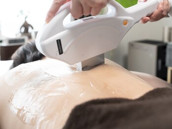 アオアクア(AOakua)/男女全身脱毛