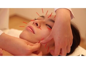 メイロン 恵比寿Mana院(meilong)/美容鍼とは?