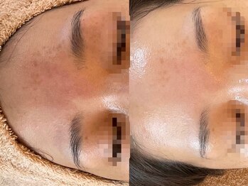 リノアンド(Lino&)/大人気のセットメニュー