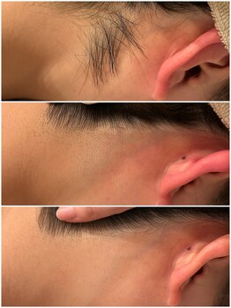 シェリール(CHIRIEUR)/エステでも結果が出る時代です