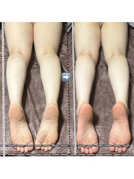 笑楽美屋/深筋骨メソッド