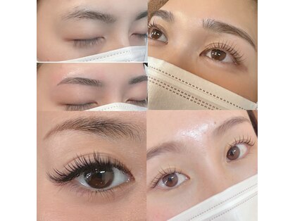 ラン(RAN)の写真