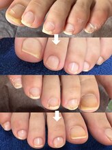 ビビィ(vivie)/自信を持てる素足づくりを応援！