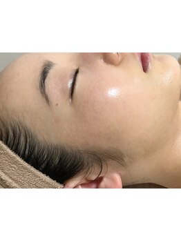 お肌をきれいにしたい