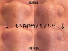 一度でも即効果実感！やればやるほど陶器のようなお肌へ導きます