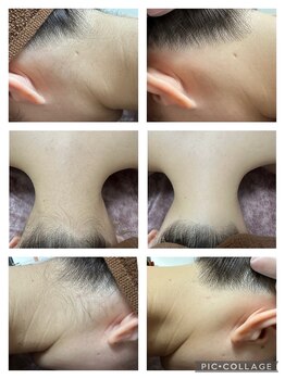 ピリナ(Pilina)/施術