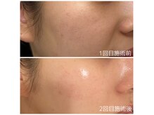 アデージョ アデオス(Ade-jyo.Adeosu)