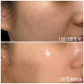 アデージョ アデオス(Ade-jyo.Adeosu)