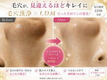 ルベル(Luvelle)の雰囲気(毛穴洗浄×LDMのメニュー、毛穴の汚れをとって水分量UP)