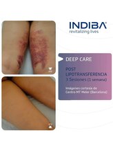 シュプリーム ラ ディオサ(Supreme LA DIOSA)/