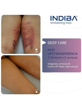 シュプリーム ラ ディオサ(Supreme LA DIOSA)/