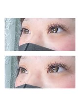 グリッターネイル(GLITTER NAILS)/アンドヘルシー