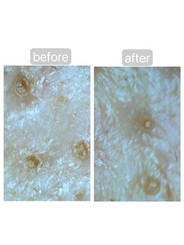 トランク(Trunk)/ハイドラ♪before→after