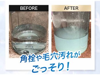 アクシア(AXIA)/ハイドラで汚れごっそり！