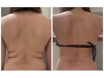 フォルチェ はません店(Folche)/下腹部/お腹/二の腕/体の厚み/腰