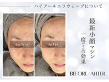 ユアーズ ビューティー(YOURS beauty)/ユアーズ式筋膜デザイン