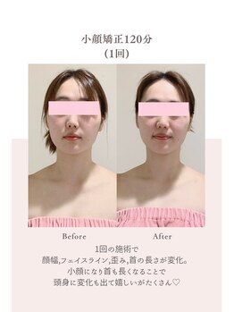 トゥインクル 麻布(twinkle)/港区/小顔矯正/勝山式美容矯正