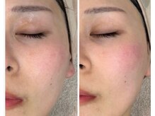 ラ メール ヴィーヴル