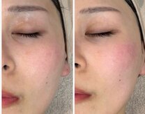 ラ メール ヴィーヴル