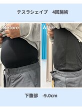 アーヒル(A”-HILU)/驚異の-9cm！