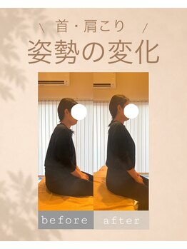アオ 香椎(AO)/before→after