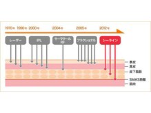 デュレーヴ(DuReve)/リフトUP最強小顔機器