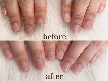 アモット(Amout)/