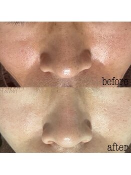 ラヴァン(LaVan)/復元磁気パック