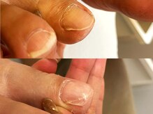 キラネイル アンド アイラッシュ by World Beauty(KIRA)/ペディグラス