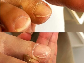 キラネイル アンド アイラッシュ by World Beauty(KIRA)/ペディグラス