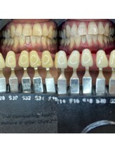 トウキョウスワーズ 池袋店(TOKYO SWRS)/#ホワイトニング #池袋 #渋谷