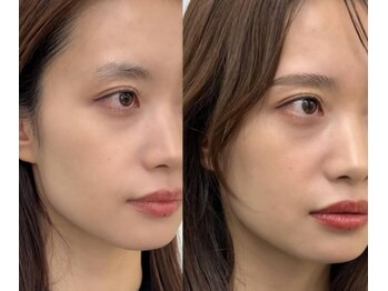 ミゼ 板橋 成増(mize)/HBL　薄眉さんも効果◎